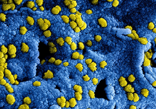" ویروس کرونا " تصویر میکروسکوپی